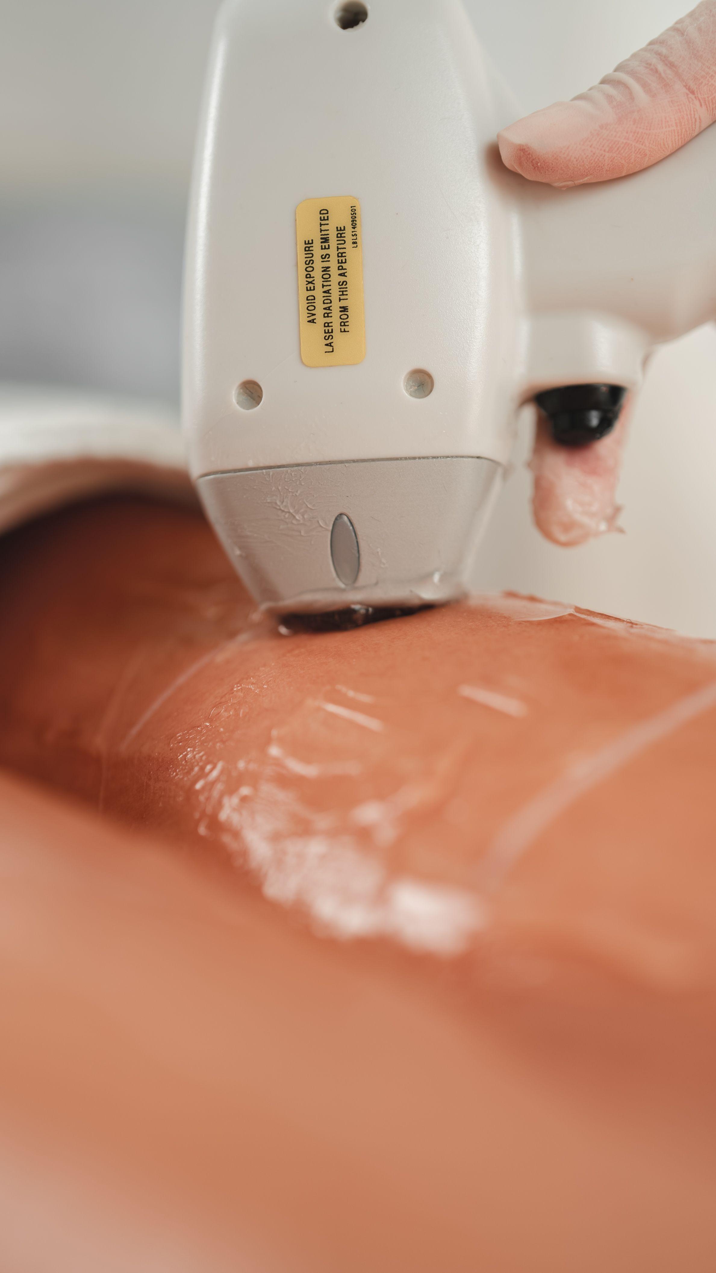 Diode laser hair removal treatment equipment